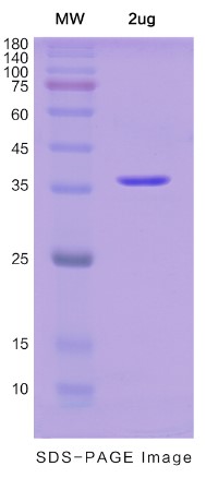 SDS-PAGE (SUMF1-5827H).jpg